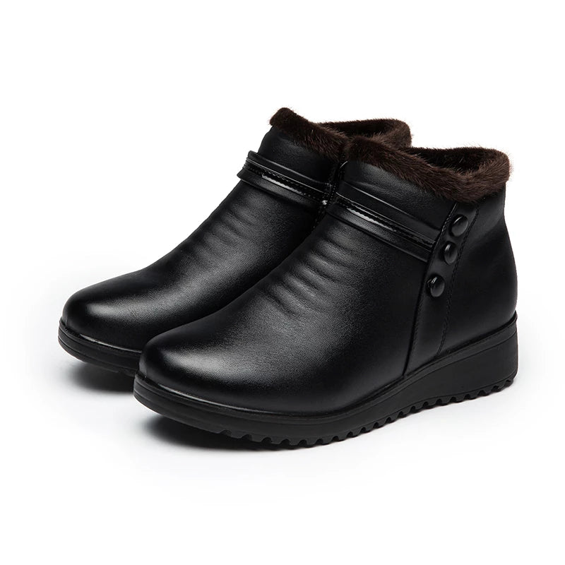 Groovywish Orthopedic Snow Boots Women Leather Ankle Shoes – GroovyWish Groovywish Orthopedic Snow Boots Women Leather Ankle Shoes – GroovyWish